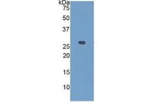 Western Blotting (WB) image for Insulin-Like Growth Factor Binding Protein 4 (IGFBP4) ELISA Kit (ABIN6730875)