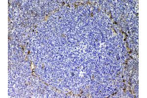 IHC analysis of CD105 using anti-CD105 antibody .