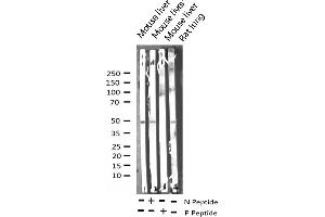 Western Blotting (WB) image for anti-Activating Transcription Factor 2 (ATF2) (pThr53), (pThr71) antibody (ABIN6255706)