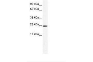 Image no. 1 for anti-Chloride Intracellular Channel 1 (CLIC1) (C-Term) antibody (ABIN6735458) (CLIC1 抗体  (C-Term))