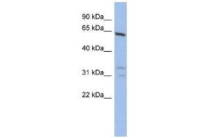 Western Blotting (WB) image for anti-General Transcription Factor IIF, Polypeptide 1, 74kDa (GTF2F1) (N-Term) antibody (ABIN2780397)