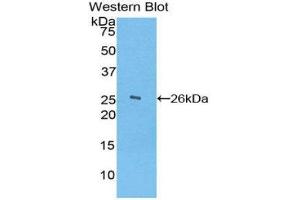 Western Blotting (WB) image for anti-Ficolin (Collagen/fibrinogen Domain Containing) 1 (FCN1) (AA 45-249) antibody (ABIN1858840) (FCN1 抗体  (AA 45-249))