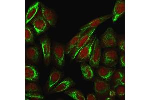 Immunofluorescence Analysis of PFA-fixed HeLa cells labeling Collagen VII using Collagen VII Mouse Monoclonal Antibody (LH7.
