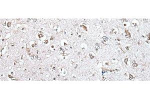 Immunohistochemistry of paraffin-embedded Human brain tissue using MCM10 Polyclonal Antibody at dilution of 1:45(x200) (MCM10 抗体)