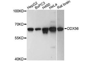 Western blot analysis of extracts of various cell lines, using DDX56 antibody. (DDX56 抗体  (AA 318-547))