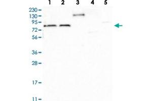 Western blot analysis of Lane 1: RT-4, Lane 2: U-251 MG, Lane 3: Human Plasma, Lane 4: Liver, Lane 5: Tonsil with TBC1D30 polyclonal antibody  at 1:100-1:250 dilution. (TBC1D30 抗体)
