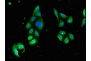 Immunofluorescent analysis of HepG2 cells using ABIN7168997 at dilution of 1:100 and Alexa Fluor 488-congugated AffiniPure Goat Anti-Rabbit IgG(H+L) (STK35 抗体  (AA 1-200))