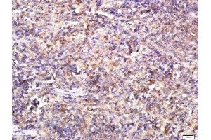 Paraformaldehyde-fixed, paraffin embedded rat spleen tissue, Antigen retrieval by boiling in sodium citrate buffer (pH6) for 15min, Block endogenous peroxidase by 3% hydrogen peroxide for 30 minutes, Blocking buffer (BSA or normal goat serum) at 37°C for 20min, Antibody incubation with TLR4 Polyclonal Antibody, Unconjugated  at 1:200 overnight at 4°C, followed by a conjugated secondary (sp-0023) for 20 minutes and DAB staining. (TLR4 抗体  (AA 121-200))