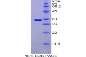 SDS-PAGE analysis of Mouse Iduronate-2-Sulfatase Protein. (IDS 蛋白)