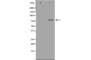 Western blot analysis of K562  lysate using RALBP1 antibody. (RALBP1 抗体  (N-Term))