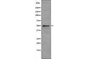 SLC1A5 antibody at 1 µg/ml + Jurkat (Human T cell lymphoblast-like cell line) Whole Cell Lysate. (SLC1A5 抗体  (Internal Region))