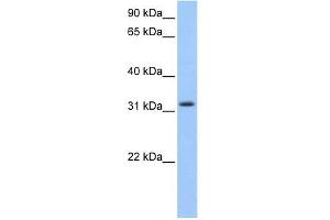 C14ORF140 antibody used at 1 ug/ml to detect target protein. (ZC2HC1C 抗体  (N-Term))