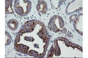 Image no. 12 for anti-Mitochondrial Ribosomal Protein S27 (MRPS27) (AA 151-414) antibody (ABIN1490963)