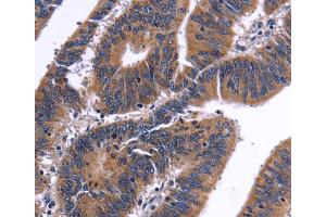 Immunohistochemistry (IHC) image for anti-Nuclear Factor of Activated T-Cells, Cytoplasmic, Calcineurin-Dependent 3 (NFATC3) antibody (ABIN2421908) (NFATC3 抗体)