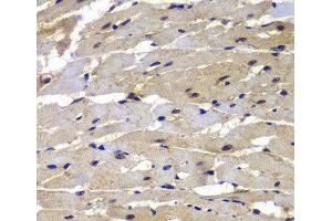 Immunohistochemistry of paraffin-embedded Rat heart using PSMB8 Polyclonal Antibody at dilution of 1:100 (40x lens). (PSMB8 抗体)