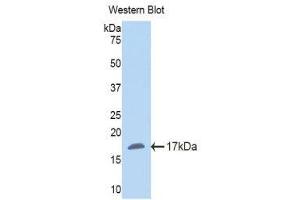 Western Blotting (WB) image for anti-Nicotinamide N-Methyltransferase (NNMT) (AA 127-249) antibody (ABIN1860014)