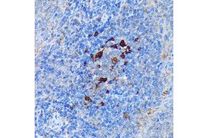 Immunohistochemistry (IHC) image for anti-Peptidyl Arginine Deiminase, Type IV (PADI4) (AA 374-550) antibody (ABIN7269207)