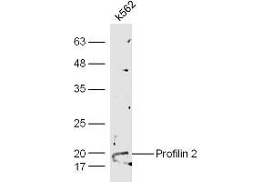 Human K562 cell lysates probed with Anti-Profilin 2 Polyclonal Antibody  at 1:5000 90min in 37˚C. (PFN2 抗体  (AA 51-140))