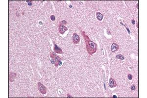 Image no. 1 for anti-Sodium Channel, Voltage-Gated, Type II, beta (SCN2B) (N-Term) antibody (ABIN372878)