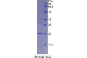 SDS-PAGE analysis of Rat NOS1 Protein. (NOS1 蛋白)