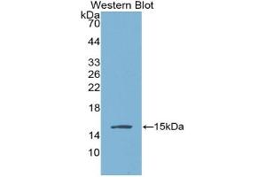 Western blot analysis of the recombinant protein. (AGGF1 抗体  (AA 406-501))