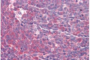 Human Tonsil: Formalin-Fixed, Paraffin-Embedded (FFPE) (GOLM1 抗体  (AA 38-87))