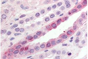 Human Kidney (formalin-fixed, paraffin-embedded) stained with GPR15 antibody ABIN213351 at 10 ug/ml followed by biotinylated goat anti-rabbit IgG secondary antibody ABIN481713, alkaline phosphatase-streptavidin and chromogen. (GPR15 抗体  (C-Term))