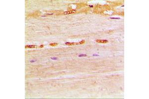 Immunohistochemical analysis of UDG staining in human muscle formalin fixed paraffin embedded tissue section. (UDG (Center) 抗体)