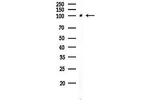 Western blot analysis of lysates from EC304 cells, using ACTN2 Antibody at 1/1000 dilution.