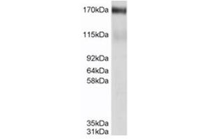 Image no. 2 for anti-ATP-Binding Cassette, Sub-Family C (CFTR/MRP), Member 4 (ABCC4) (C-Term) antibody (ABIN374484) (ABCC4 抗体  (C-Term))