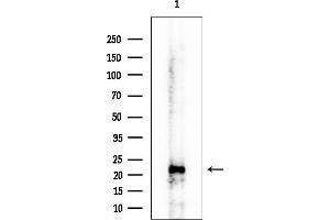 Western blot analysis of lysates from Mouse kidney, using BID Mouse Monoclonal Antibody at 1/1000 dilution.