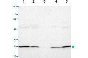 Western blot analysis of Lane 1: Human cell line RT-4, Lane 2: Human cell line U-251MG sp, Lane 3: Human plasma (IgG/HSA depleted), Lane 4: Human liver tissue, Lane 5: Human tonsil tissue with PSMD10 polyclonal antibody  at 1:250-1:500 dilution. (PSMD10 抗体)