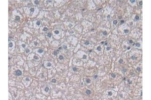 Immunohistochemistry (IHC) image for anti-Methylenetetrahydrofolate Reductase (NAD(P)H) (MTHFR) (AA 1-325) antibody (ABIN7436504)