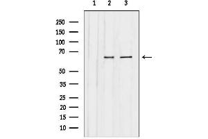anti-Chromatin Assembly Factor 1, Subunit B (p60) (CHAF1B) (N-Term) antibody