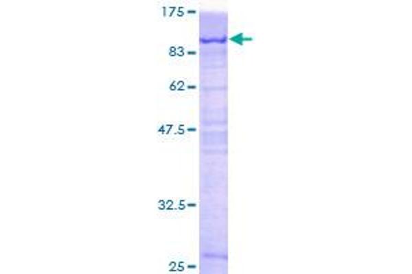 PCM1 Protein (AA 1-530) (GST tag)