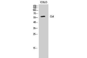 Western Blotting (WB) image for anti-Carnitine O-Octanoyltransferase (CROT) (Ser253) antibody (ABIN3174521) (CROT 抗体  (Ser253))