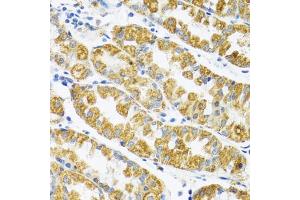 Immunohistochemistry of paraffin-embedded human stomach using POLG2 antibody (ABIN6132502, ABIN6145894, ABIN6145895 and ABIN6222405) at dilution of 1:100 (40x lens).