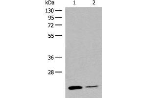 Western blot analysis of Human empty ileal tissue and Human ileum tissue lysates using RAC3 Polyclonal Antibody at dilution of 1:400 (RAC3 抗体)