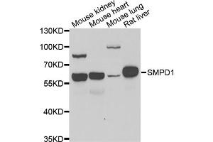 Western blot analysis of extracts of various cell lines, using SMPD1 antibody (ABIN5974079) at 1/1000 dilution. (SMPD1 抗体)