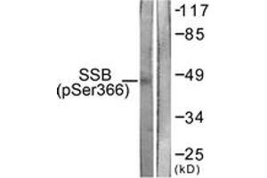 Western blot analysis of extracts from 293 cells, using SSB (Phospho-Ser366) Antibody. (SSB 抗体  (pSer366))