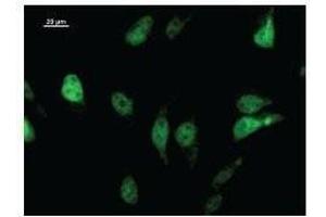 Immunostaining analysis in HeLa cells. (LHX2 抗体)