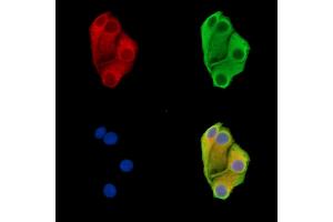ABIN7096491 and ABIN7100555 staining Hela cells by IF/ICC. (DENND2D 抗体)
