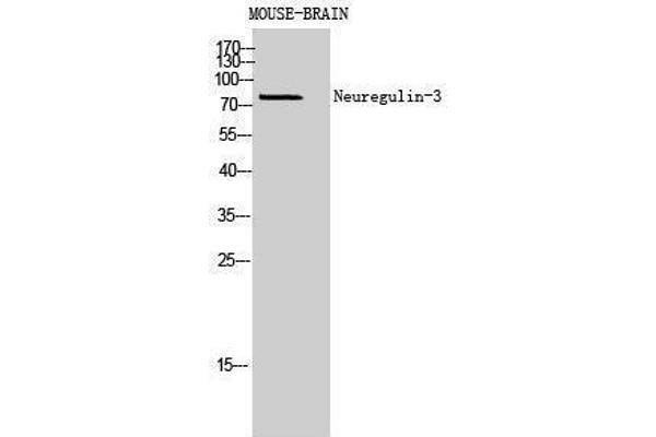 Neuregulin 3 抗体  (Internal Region)