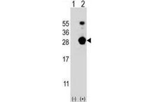 Western blot analysis of FKBP7 (arrow) using FKBP7 / FKBP23 Antibody (C-term); 293 cell lysates (2 ug/lane) either nontransfected (Lane 1) or transiently transfected (Lane 2) with the FKBP7 gene. (FKBP7 抗体  (C-Term))