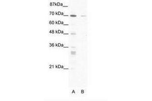 Image no. 1 for anti-Zinc Finger Protein 37A (ZNF37A) (AA 381-430) antibody (ABIN203208) (ZNF37A 抗体  (AA 381-430))