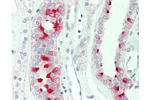Immunohistochemistry (IHC) image for anti-ATPase, H+ Transporting, Lysosomal 14kDa, V1 Subunit F (ATP6V1F) antibody (ABIN2617350)