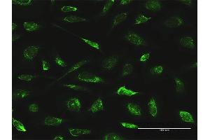 Immunofluorescence of purified MaxPab antibody to AIFM1 on HeLa cell.