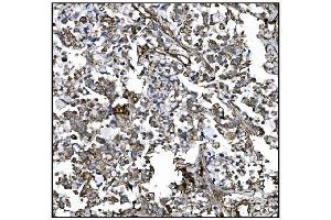 IHC analysis of CD39/ENTPD1 using anti-CD39/ENTPD1 antibody (ABIN7602461).