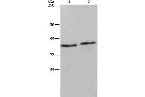 Western Blot analysis of 293T and K562 cell using ITGB2 Polyclonal Antibody at dilution of 1:600 (Integrin beta 2 抗体)
