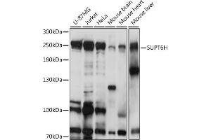 Western blot analysis of extracts of various cell lines, using SUPT6H antibody (ABIN7270645) at 1:1000 dilution. (Spt6 抗体  (AA 1500-1726))